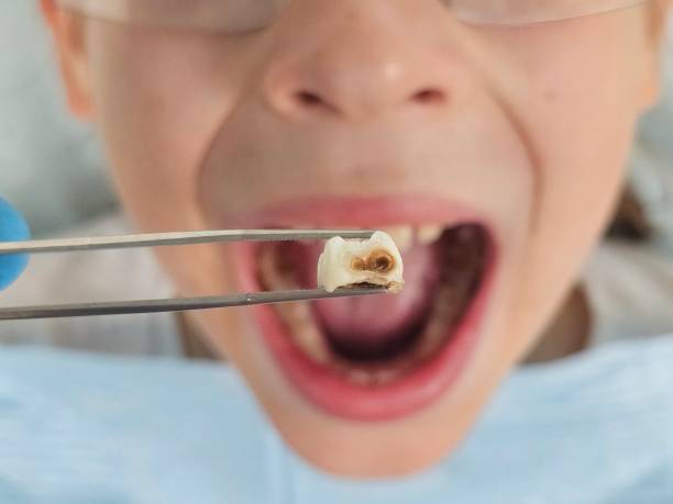 Best Knocked-Out Tooth Emergency  in Rkville, PA
